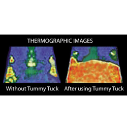 Transform Tummy Tuck Belt&nbsp;&nbsp;Model#&nbsp;BK0033