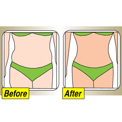 Transform Tummy Tuck Belt&nbsp;&nbsp;Model#&nbsp;BK0033