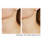 ElimiTag-Skin Tag Remover - 2 Bottles